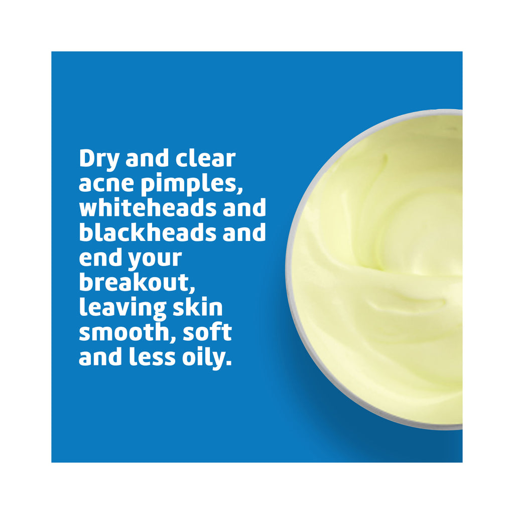 De La Cruz Sulfur Ointment Acne Medication Maximum Strength 73.7g