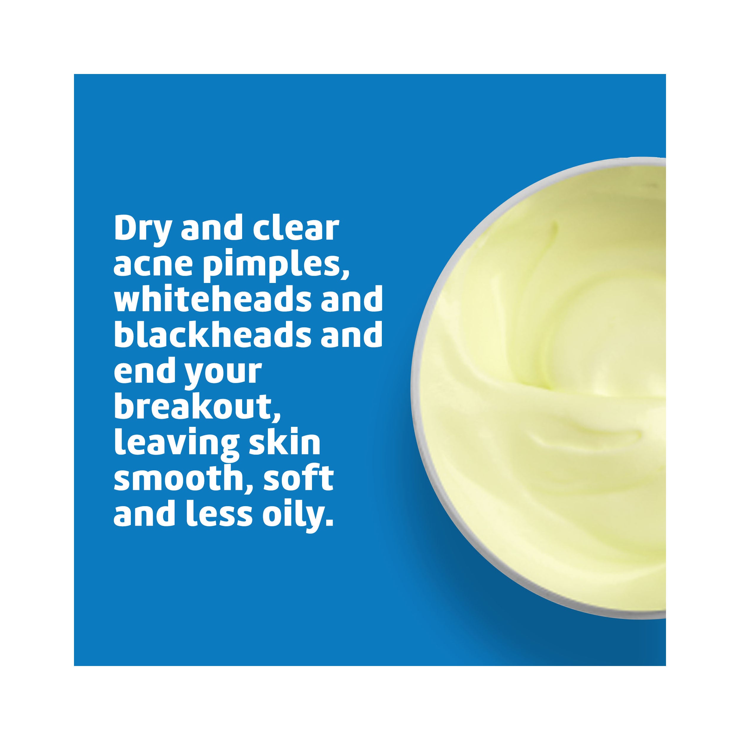 De La Cruz Sulfur Ointment Acne Medication Maximum Strength 73.7g