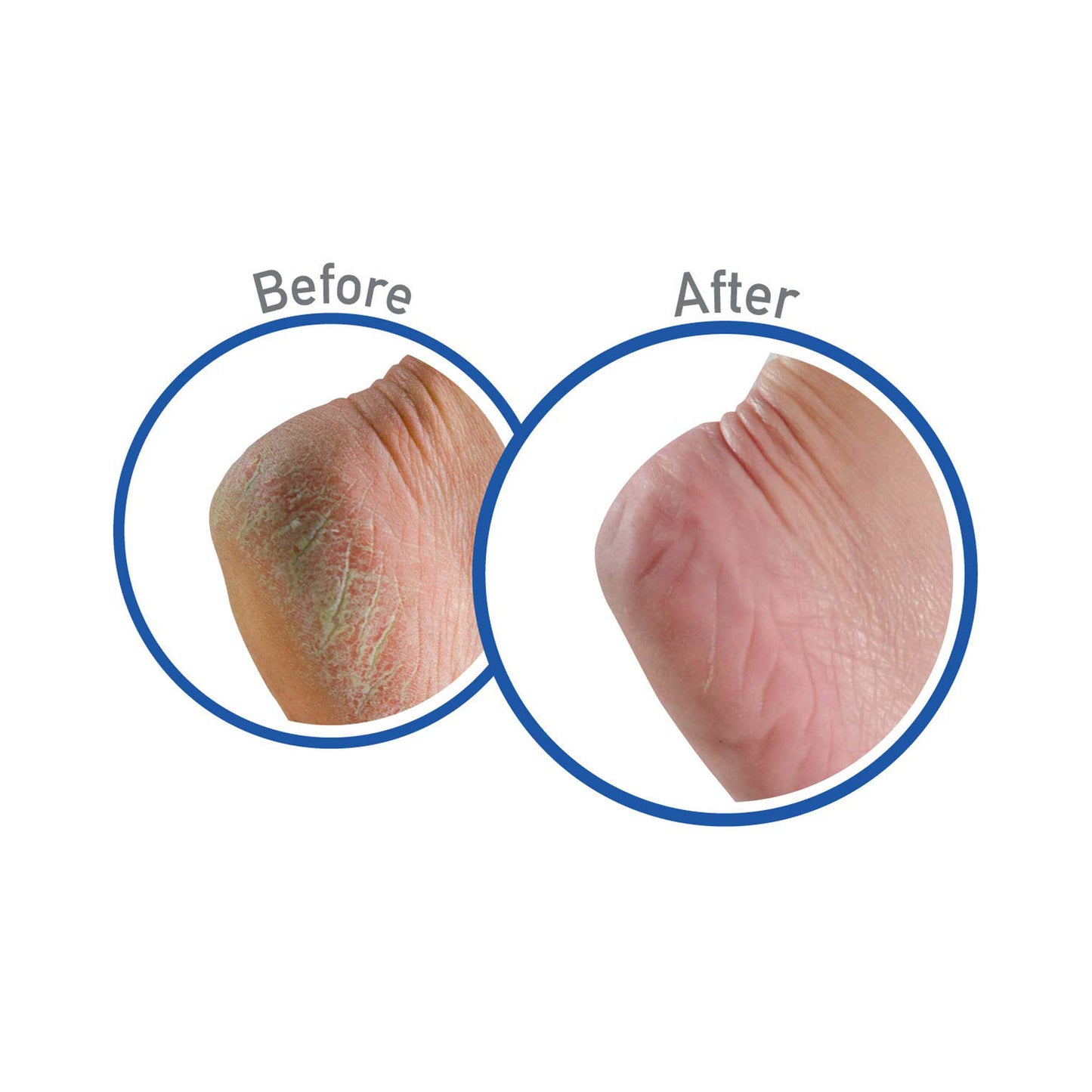 O'Keeffe's Foot Cream for Healthy Feet 91g