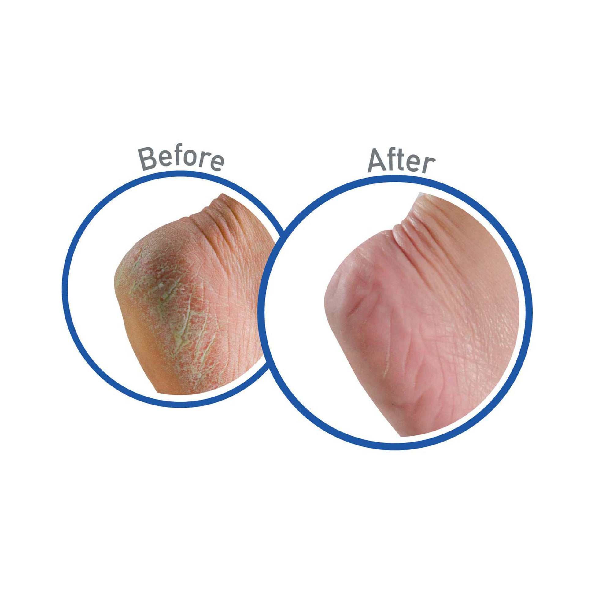O'Keeffe's Foot Cream for Healthy Feet 91g